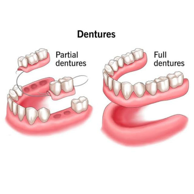 Denture