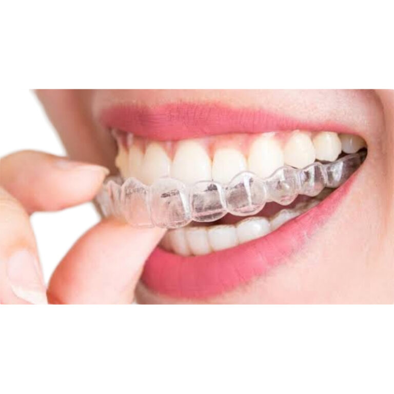 Invisalign