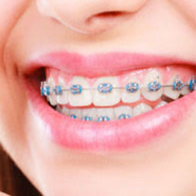 Orthodontics