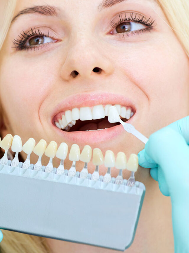 Cosmetic Dentistry